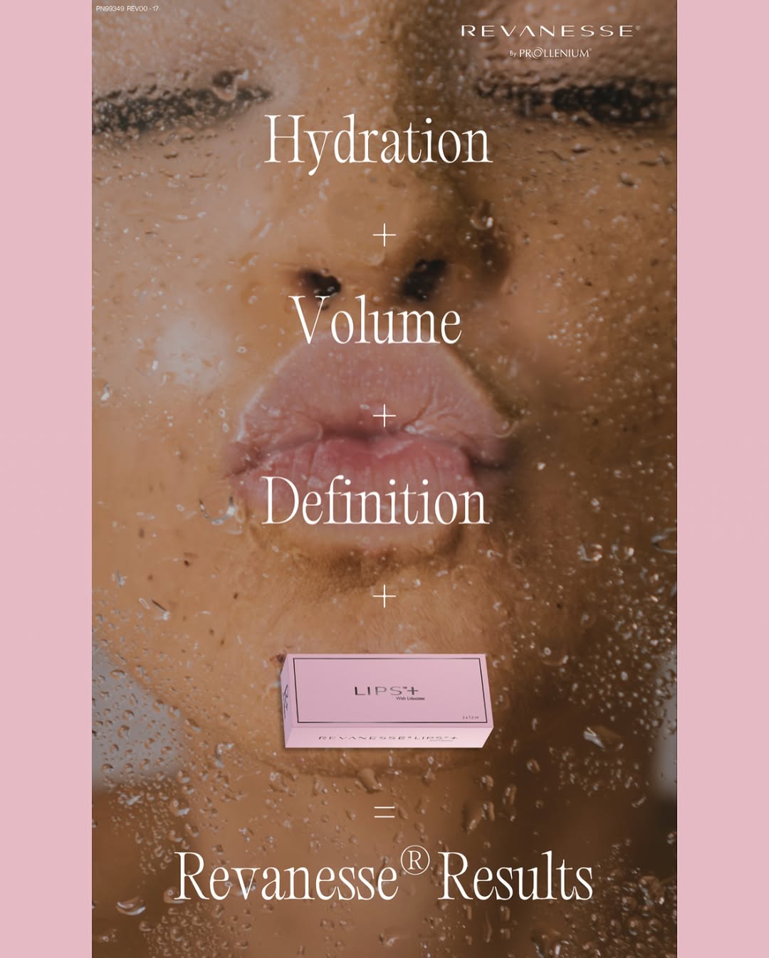 Instagram post by Dr. Ted Brezel: 💋 Hydration. Volume. Definition. 💋 Meet Radiesse® — a calcium-based filler known for its thicker, more sculpting consistency, making it id…