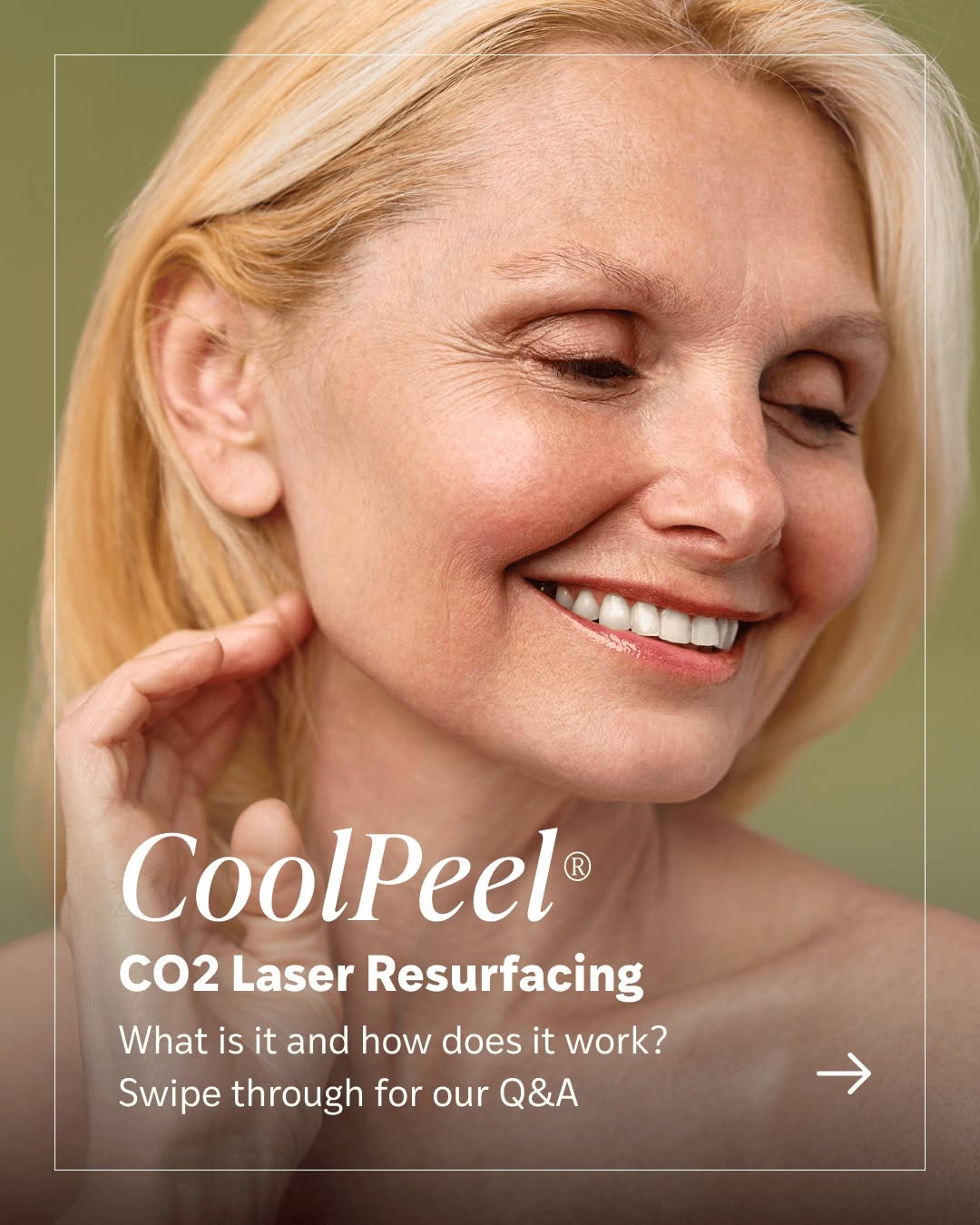 Instagram post by Dr. Terence Michael Myckatyn: Aging, sun exposure, and environmental factors can affect skin thickness, tone, and texture over time. SmartXide Tetra CO2 laser resurfacing…