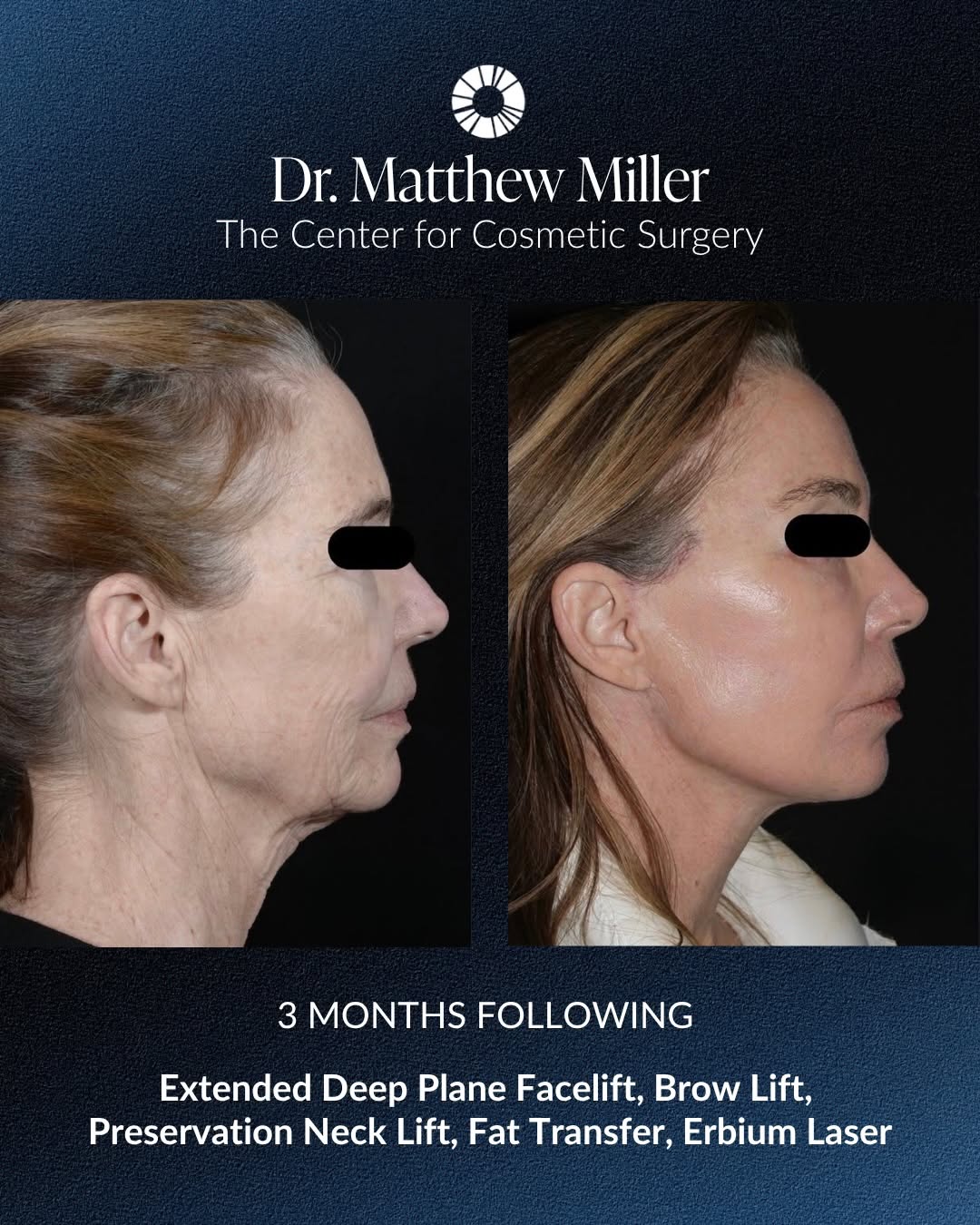 Instagram post by Dr. Teresa C. Cunningham: The Golden Hour is almost here! Join CCS and our neighbors at Rejuvenate MedSpa for an evening exploring how facial surgery and advanced las…