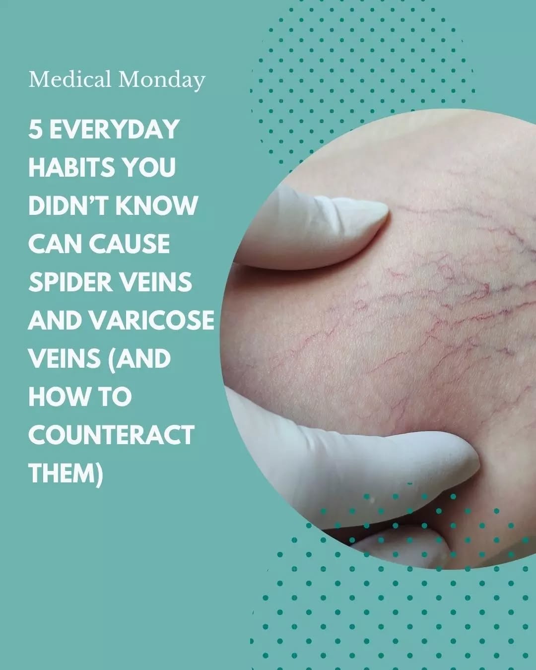 Instagram post by Dr. Teresa Mann: 🕷️ Spider veins? Not exactly the kind of spiders we want hanging around. Some everyday habits and activities may contribute to spider and v…