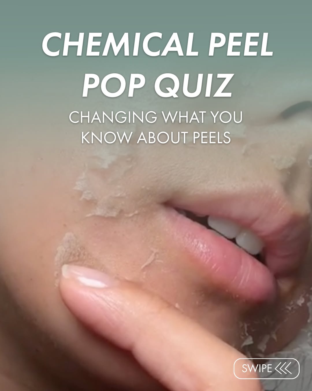 Instagram post by Dr. Terry J. Perkins: Think you know chemical peels? Think again. A @vipeel isn't your typical chemical peel. It's more comfortable than most clients expect, and …