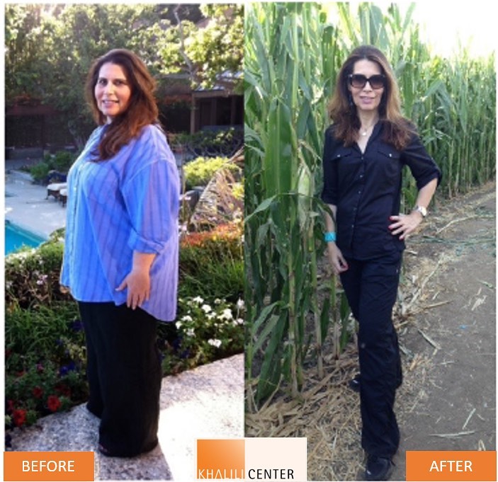 Instagram post by Dr. Theodore M. Khalili: #weighlosstransformation ❤️✨💃🏻Our beautiful patient had surgery with Dr. Khalili, Basseri, and Nishi. We are so proud of you. Thank you fo…