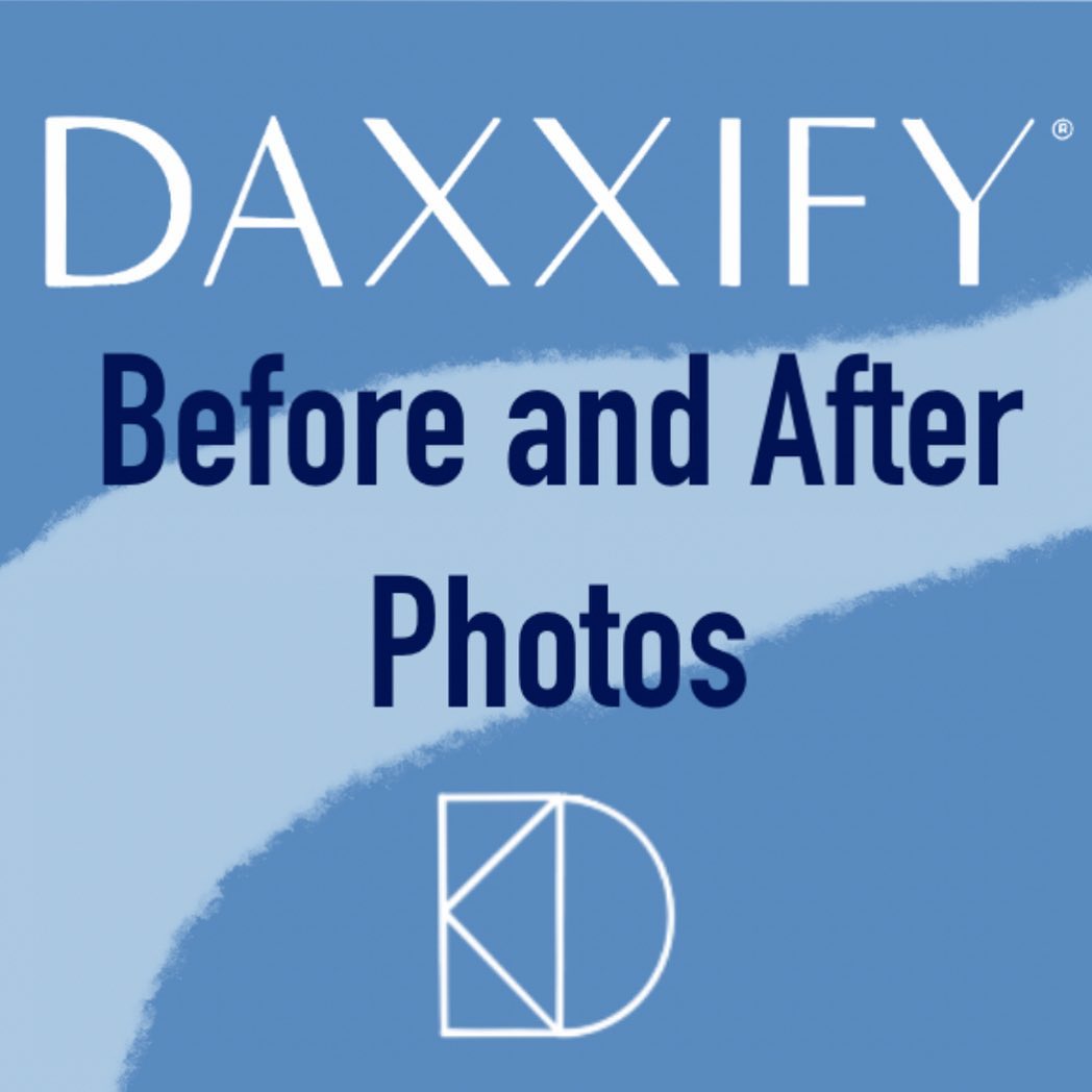 Instagram post by Dr. Theodore T. Foley: • What is DAXXIFY™? 💉Daxxify is a new injectable wrinkle treatment that is FDA-approved. This new injection treatment softens the appearanc…