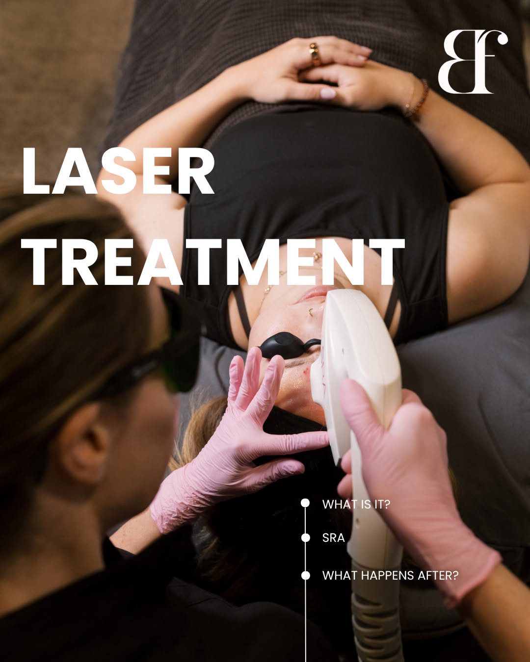 Instagram post by Dr. Theresa M. Jarmuz: Fall is officially laser season! 🍂 Time to leave summer skin behind and give your complexion a fresh start. SRA helps target sun spots, red…