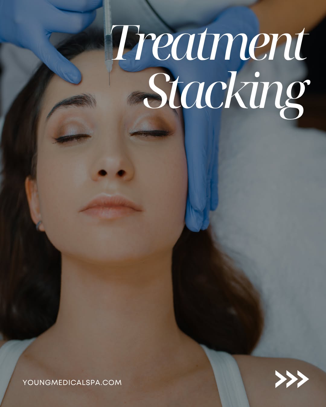 Instagram post by Dr. Thomas E. Young: Treatment stacking is all about creating a more complete, personalized approach to your aesthetic goals.⁠ ⁠ At Young Medical Spa, BOTOX® can…
