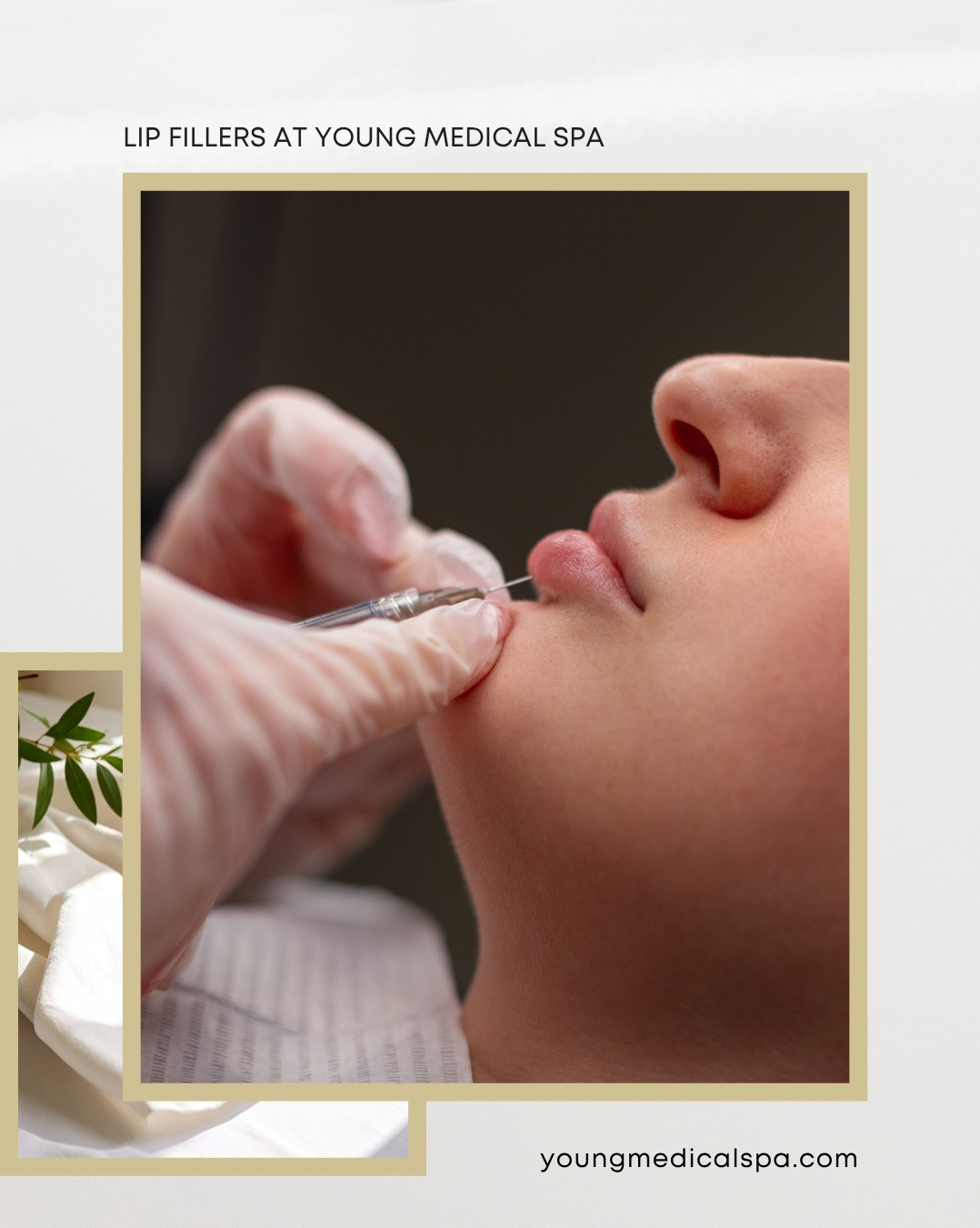 Instagram post by Dr. Thomas E. Young: Did you know - lip filler treatments can help improve balance and symmetry between the upper and lower lips for a more harmonious appearance…