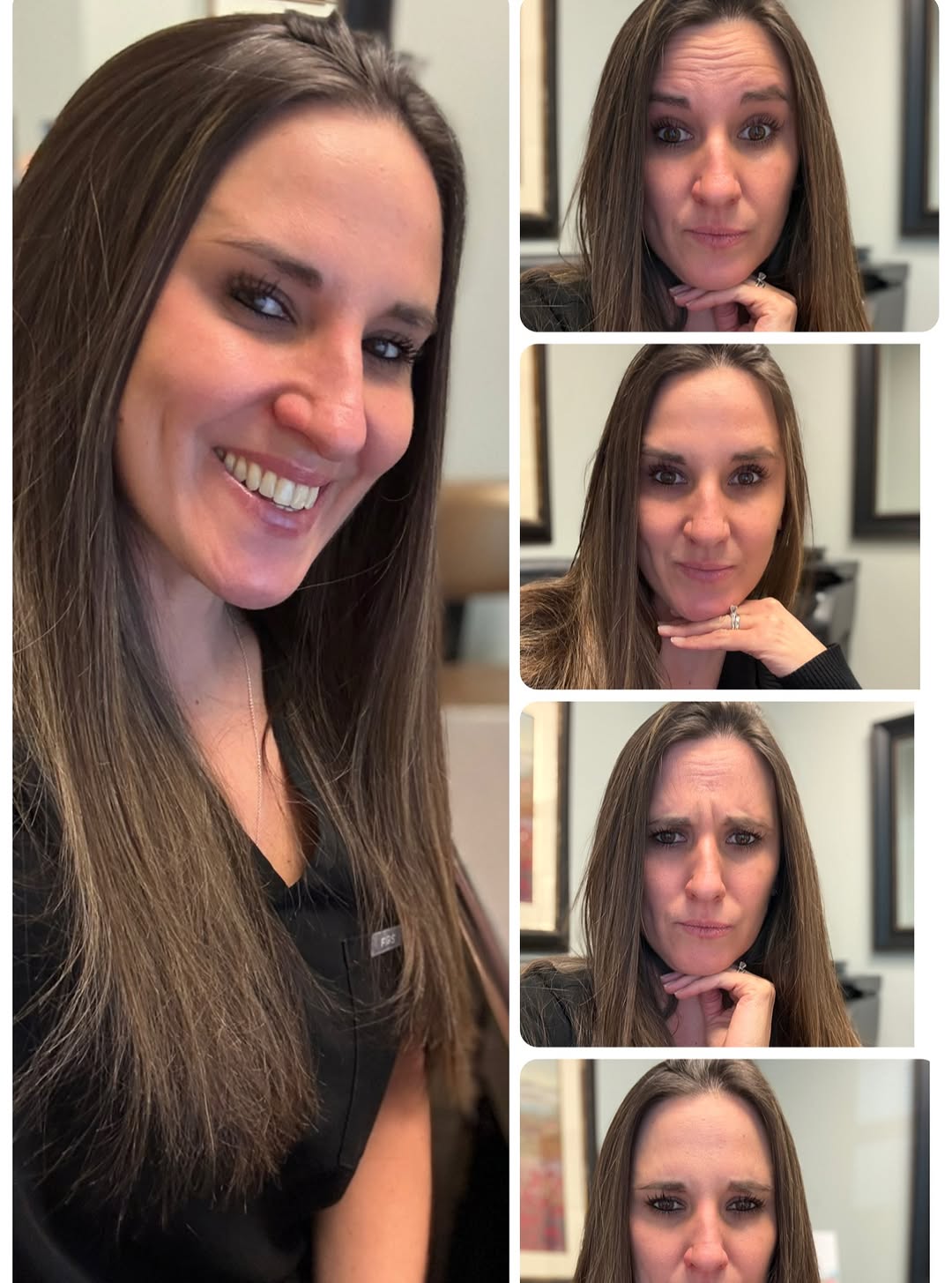 Instagram post by Dr. Thomas G. Liszka: Results you can SEE. No filter. No facial makeup (other than mascara). Just some Botox and great skincare can go a long way. Call today to s…
