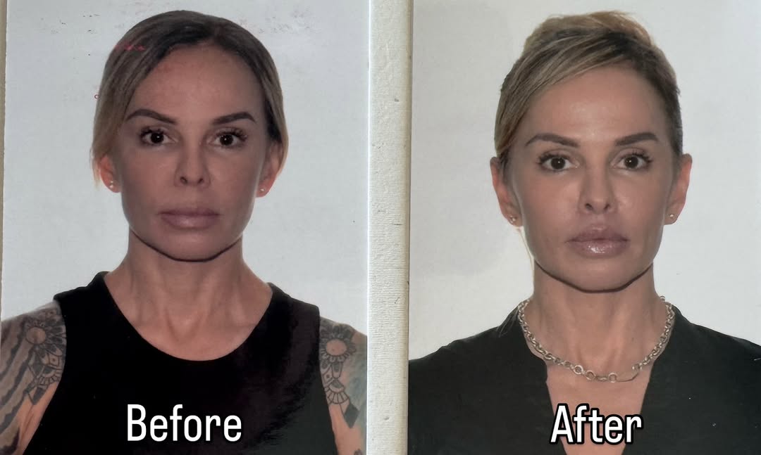 Instagram post by Dr. Thomas S. Taylor: This photo was sent to us from our patient who had her passport photo rejected and sent back to her. She originally took her passport pic ar…