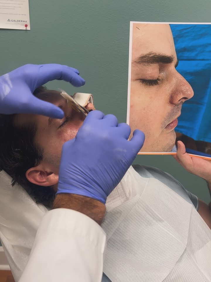 Instagram post by Dr. Thomas Trevisani: So excited for this handsome young patient to see his nose for the first time! Even though still early post op - only 2 weeks- his nose look…