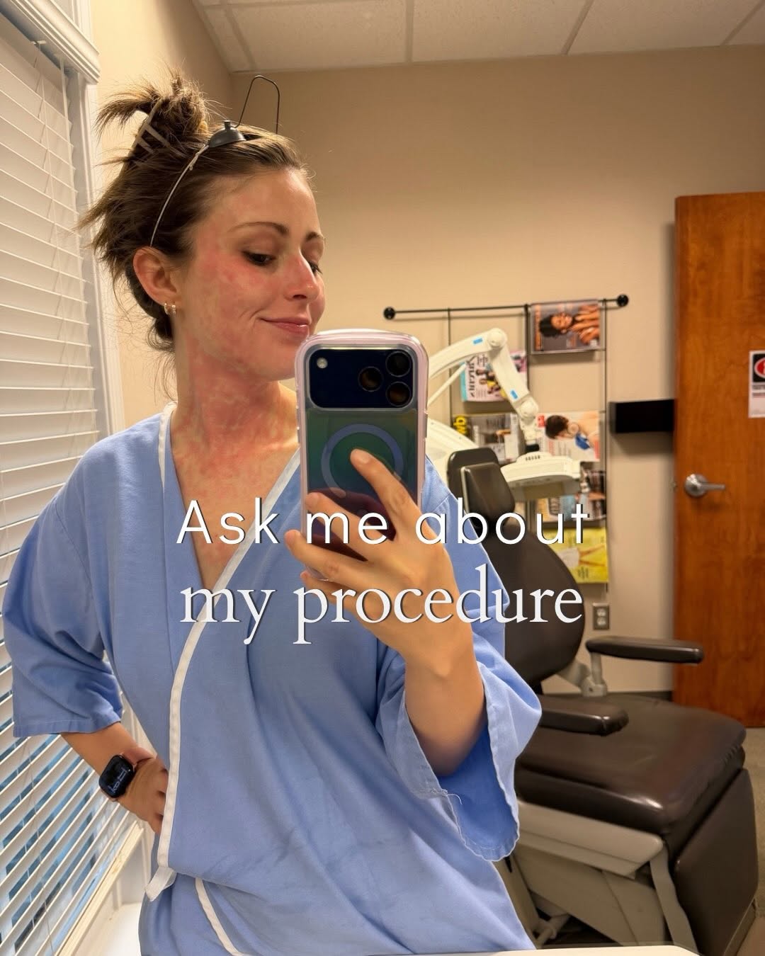 Instagram post by Dr. Tiffani Hamilton: ➡️Swipe to see what I had done✨ #lasertreatment #picowayresolve #fractionallaser
