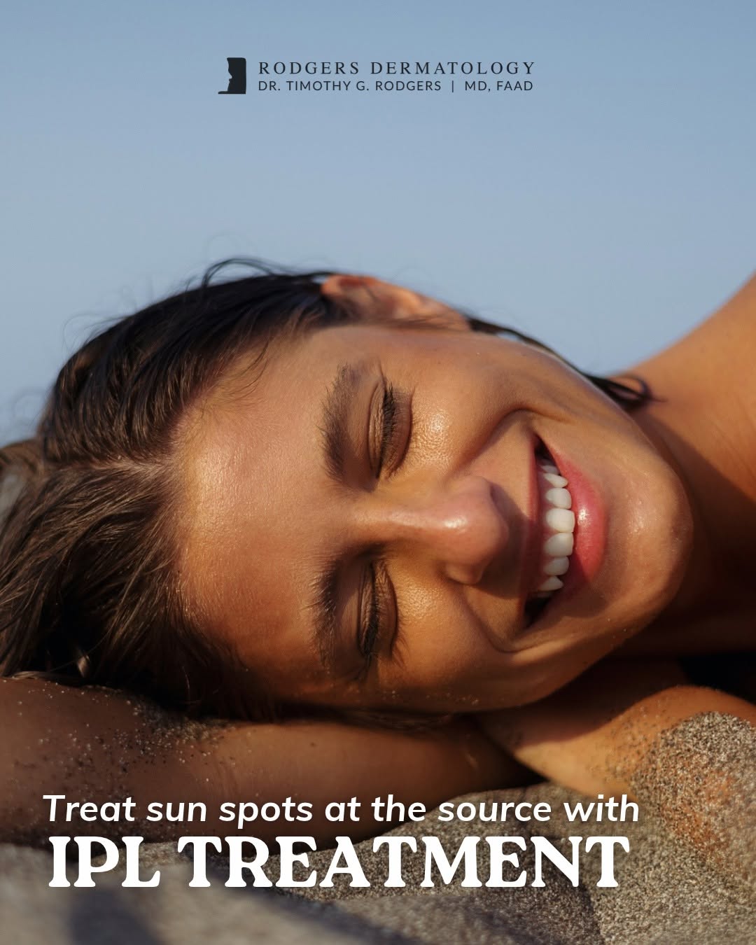 Instagram post by Dr. Timothy G. Rodgers: After months of sun exposure, it's common to notice new spots or uneven tone that weren't there in spring. IPL targets pigment beneath the s…