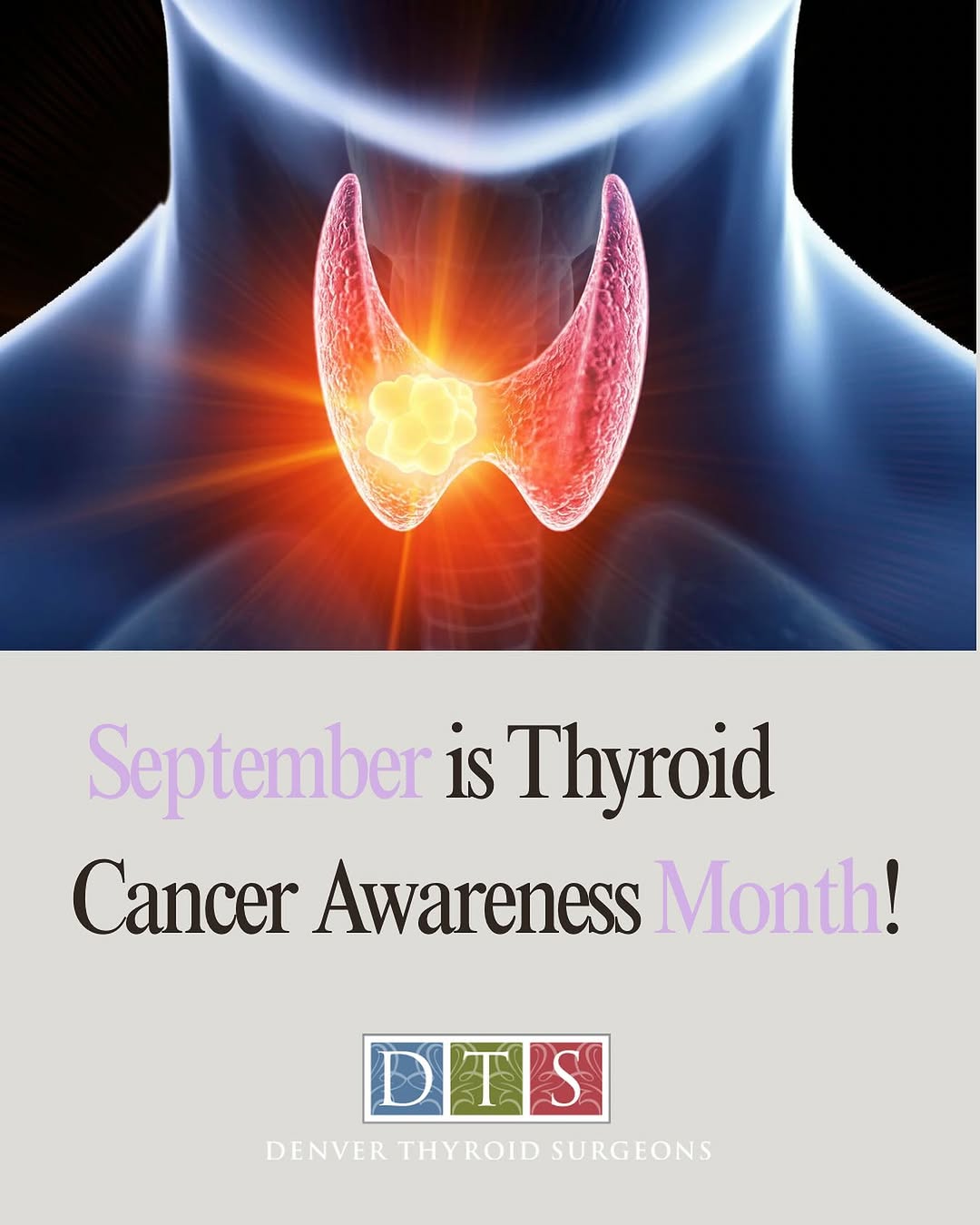 Instagram post by Dr. Timothy Pingree: 💙 Your thyroid may be small, but it plays a huge role in your overall health. Thyroid cancer often develops silently with few early symptom…