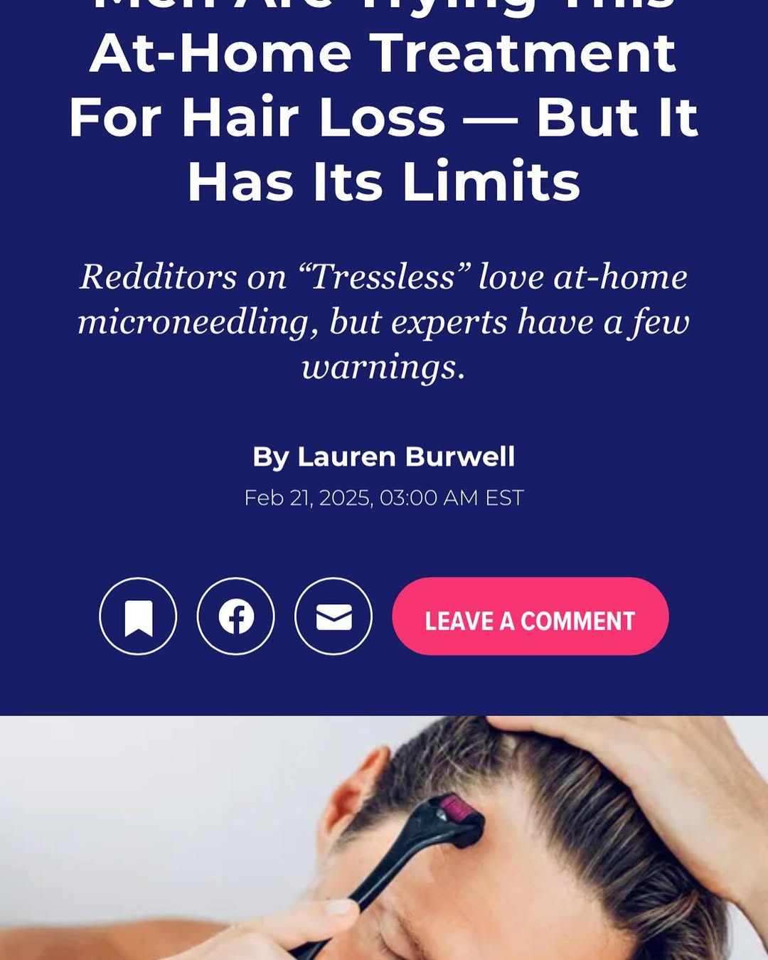 Instagram post by Dr. Tito Vasquez: https://www.huffpost.com/entry/men-microneedling-for-hair-loss_l_67b2aca5e4b0c6b4a5043345. Quoted in the Huffington Post 🤓