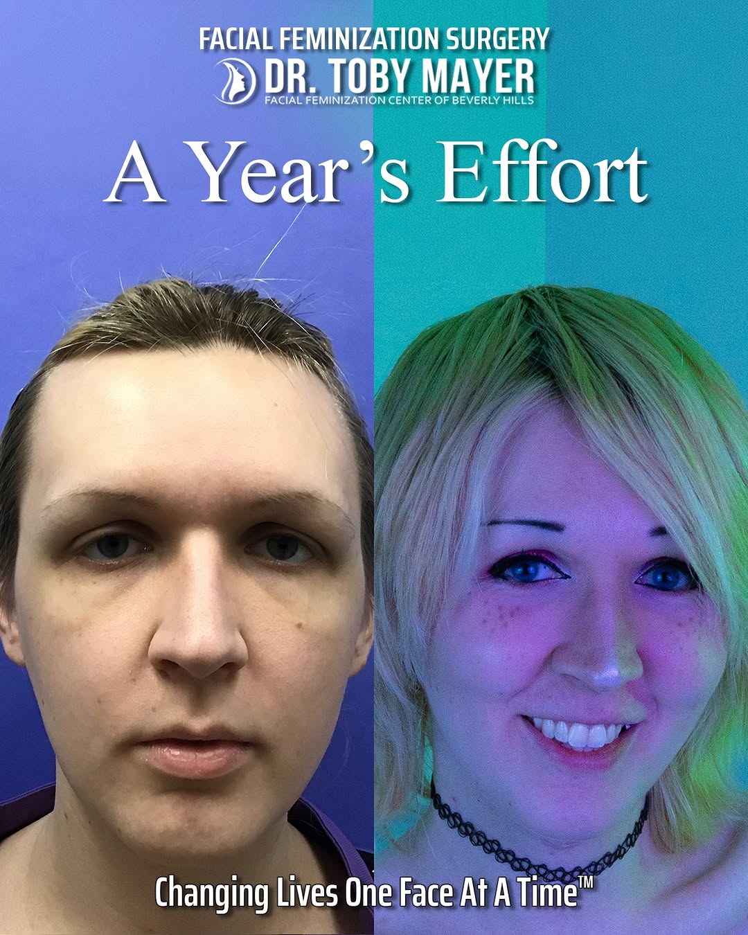 Instagram post by Dr. Toby Mayer: We are so proud to share Ellen's one year results today. Her transformation is a perfect example of what can be achieved through personalize…