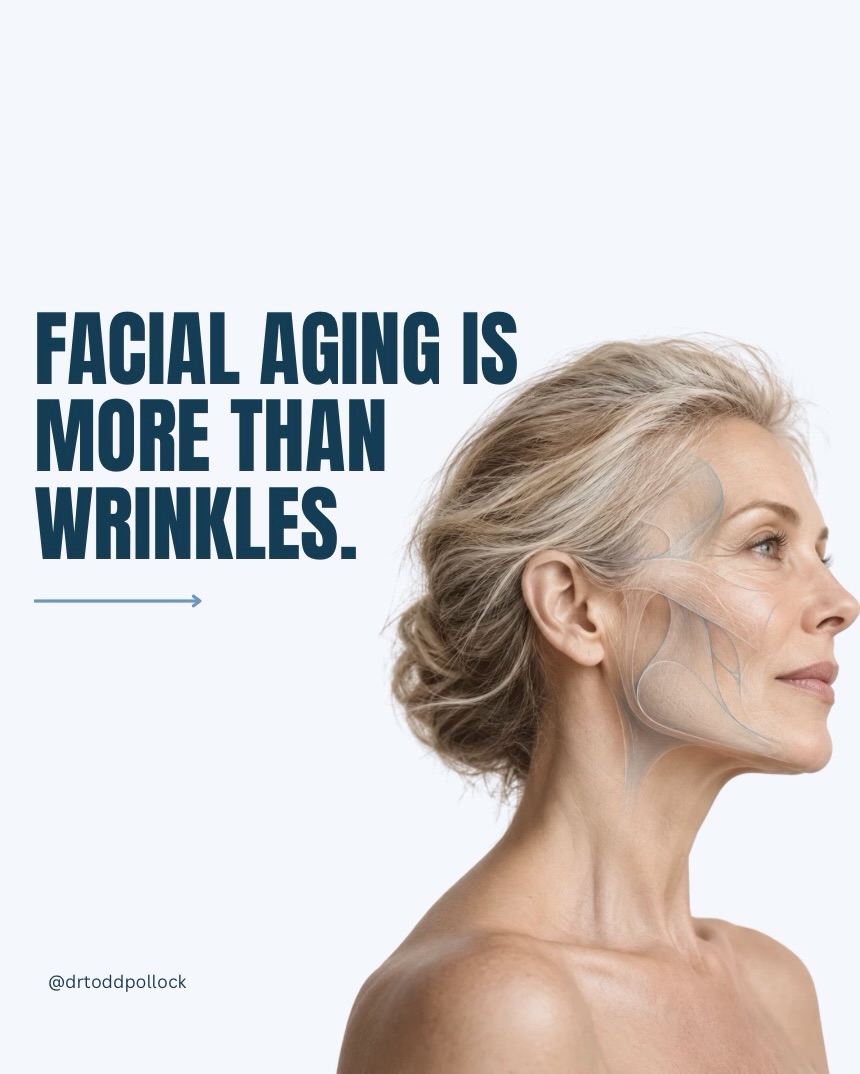 Instagram post by Dr. Todd Pollock: Wrinkles are only one piece of facial aging. Over time, the skin loses collagen, facial volume shifts, deeper tissues descend, and even the …