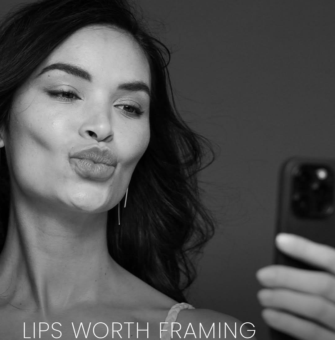 Instagram post by Dr. Tracy Kuykendall: Are you ready for your close-up? Experience a modern approach to lip rejuvenation with the #RHACollection -dynamic fillers made to enhance l…