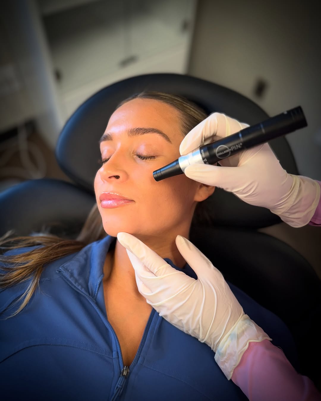 Instagram post by Dr. Tracy Kuykendall: ✨Reveal Your Radiance with Microneedling✨ Performed by our expert board-certified dermatologist, microneedling is a safe and effective way t…