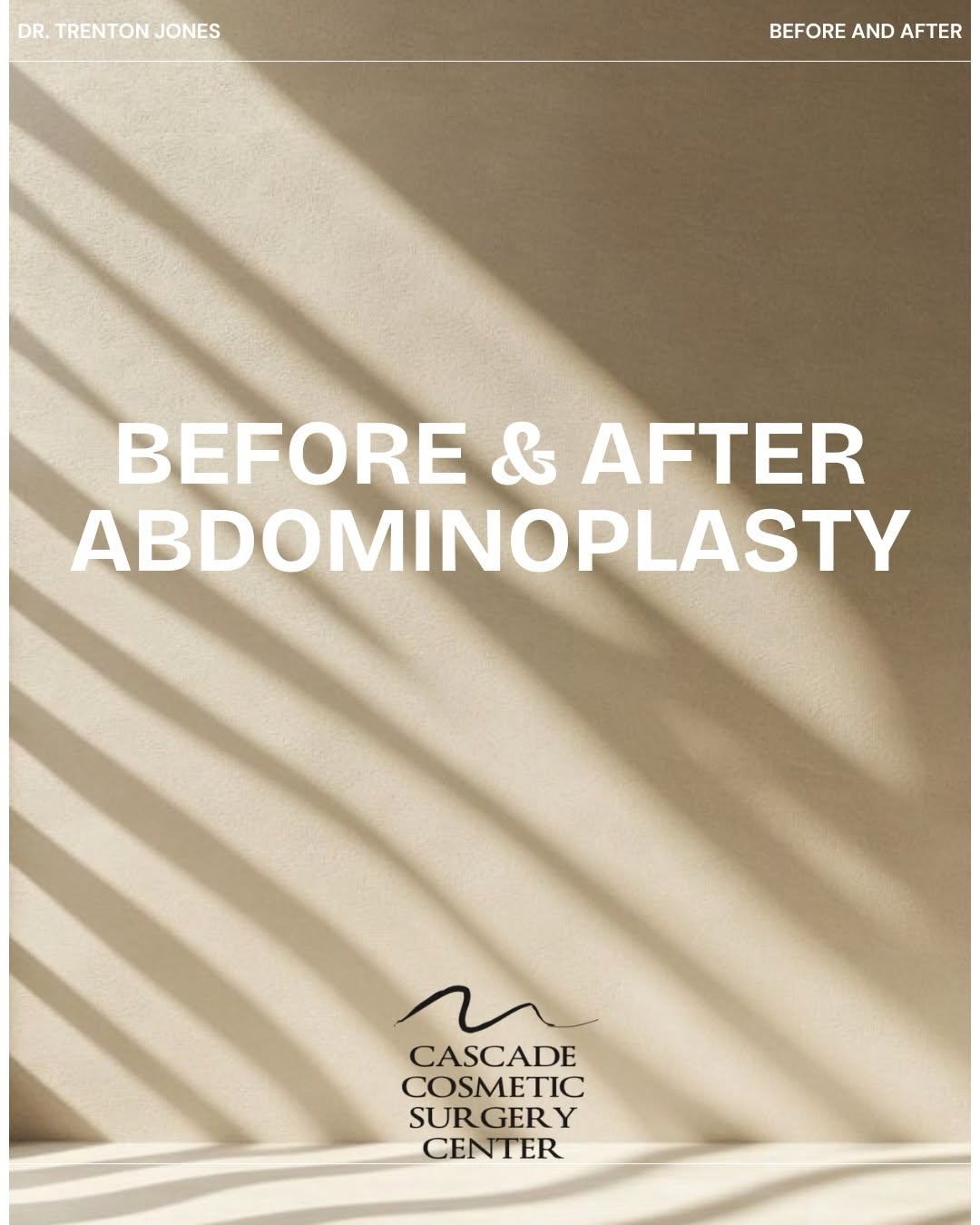 Instagram post by Dr. Trenton C. Jones: ✨ Abdominoplasty (Tummy Tuck) Transformation ✨ This beautiful before & after showcases the power of an abdominoplasty—removing excess skin, …