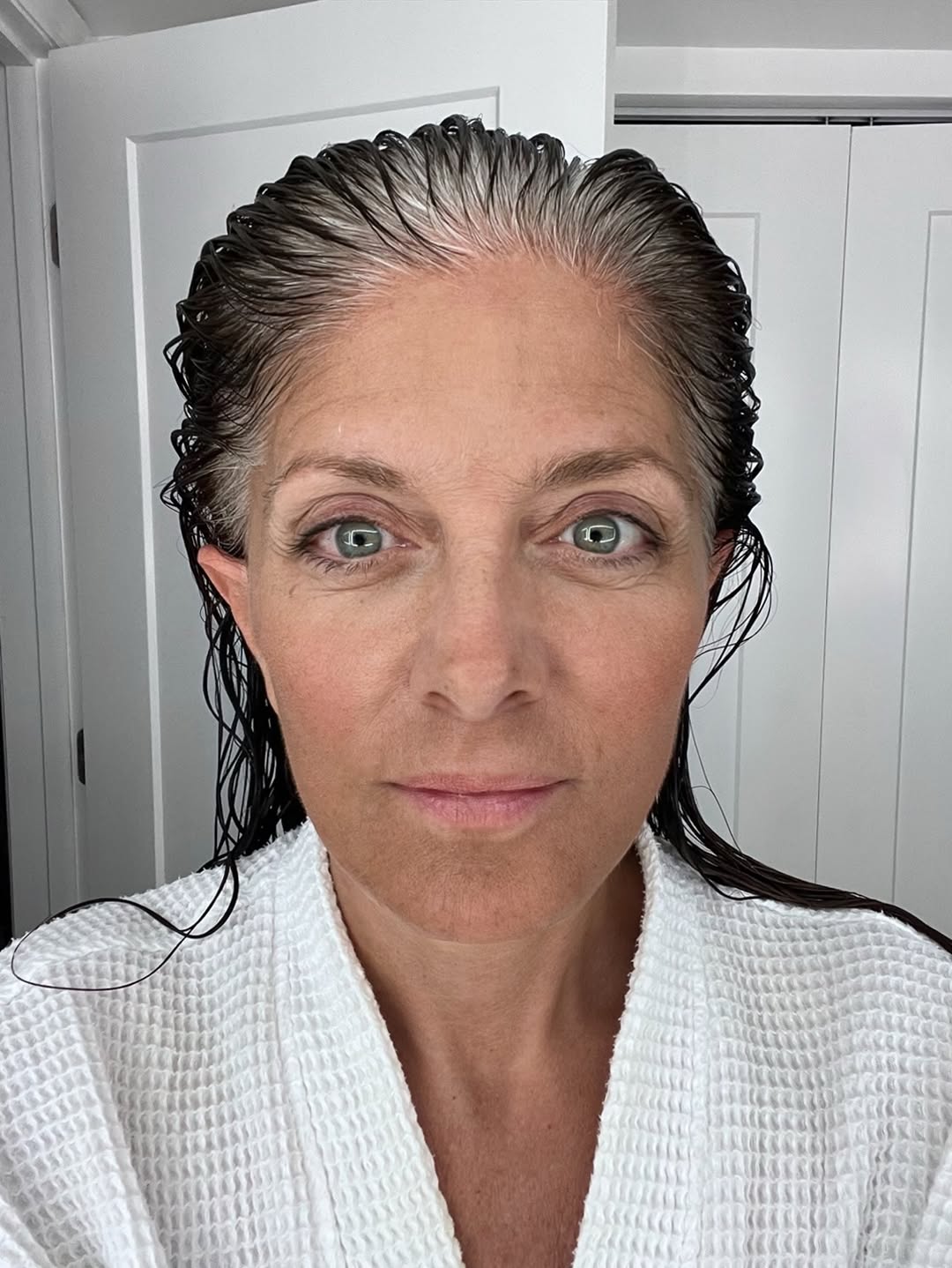 Instagram post by Dr. T.Y. Steven Ip: One Month post op No make up- Was cleared to have my hair colored but since I was going to be in salt water I decided to wait -greys are rea…