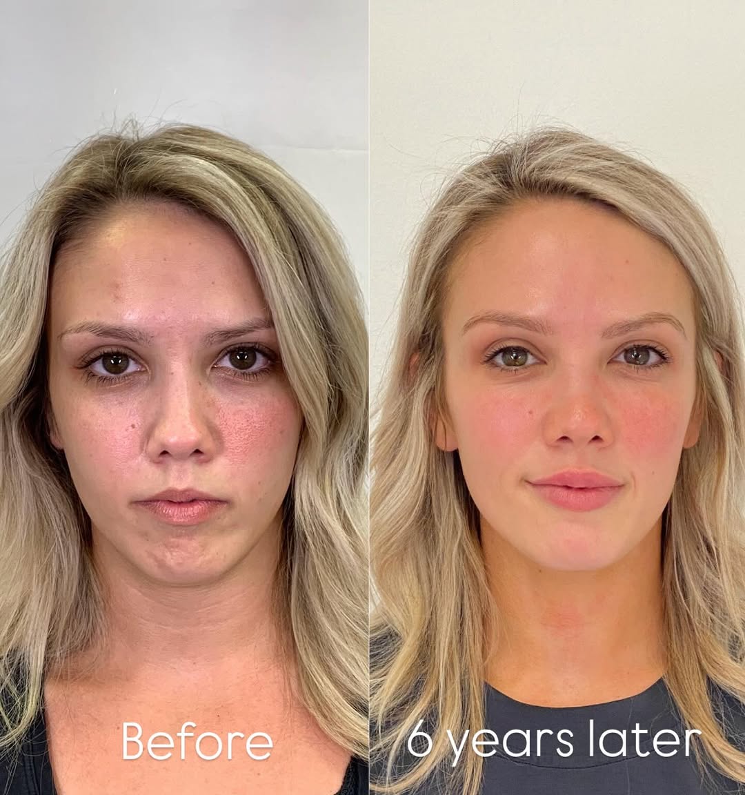 Instagram post by Dr. Umbreen Chaudhary: Great results don’t come from a single treatment, they come from having a long term plan. And getting that plan is the purpose of your consu…