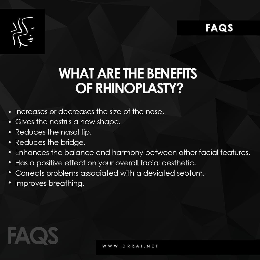 Instagram post by Dr. Vasdev Rai: Schedule your consultation with our team today to find out if neck lift surgery is right for you! (972) 392-3511 DrRai.Net #CosmeticSurgical…