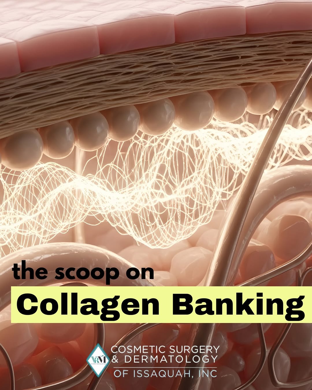 Instagram post by Dr. Victor Michalak: Ever heard of collagen banking? It’s a term that started making its way around aesthetics 15+ years ago right around the time Ultherapy came…