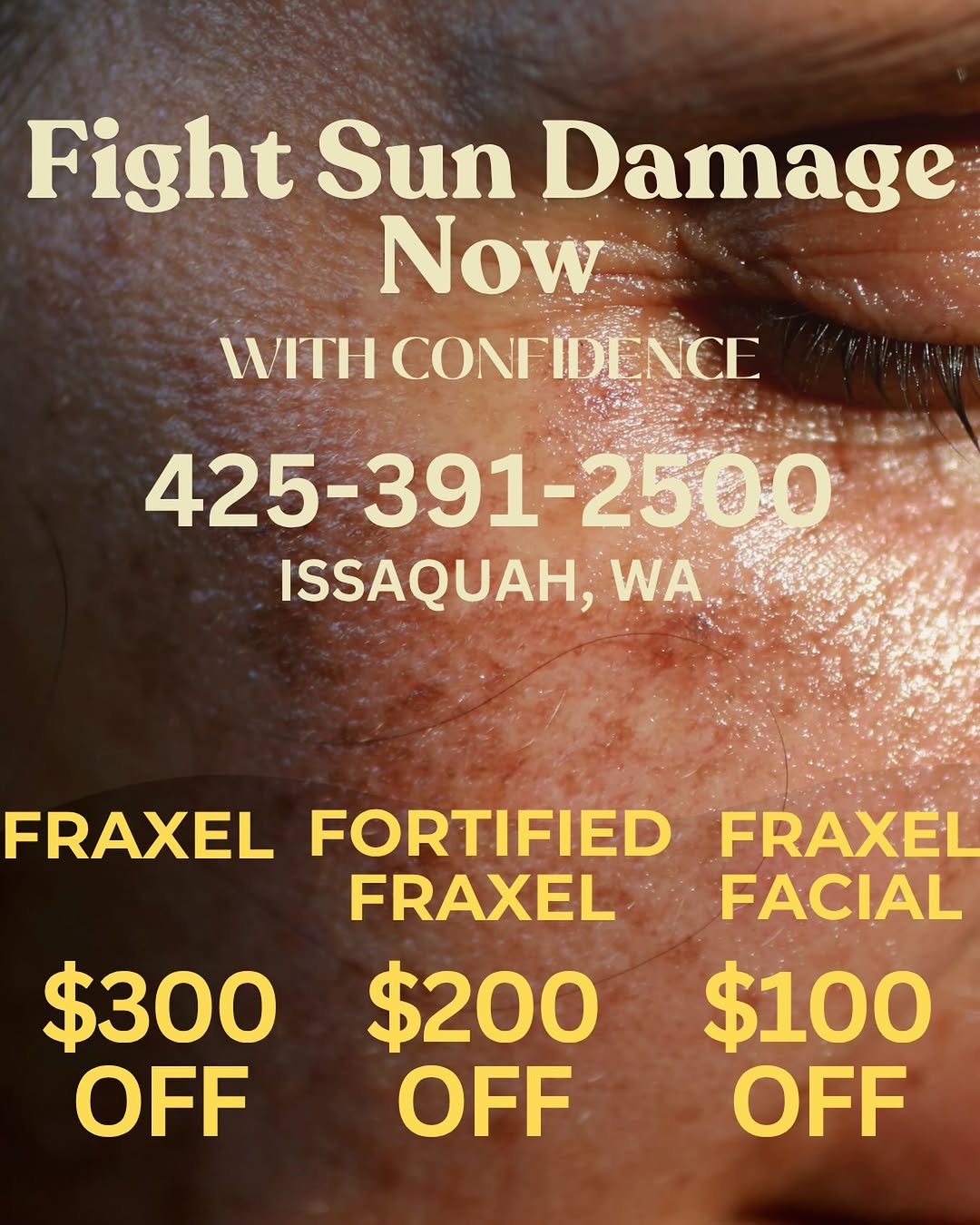 Instagram post by Dr. Victor Michalak: Fraxel specials are hands down our most popular promo we run throughout the year. Why? Because they treat a variety of the most common conce…