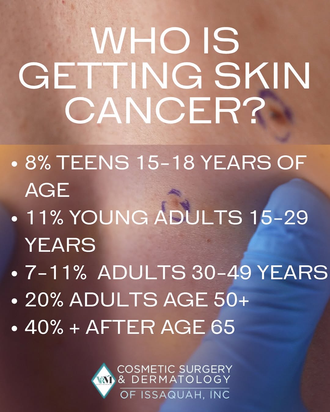 Instagram post by Dr. Victor Michalak: Seeing the numbers can be helpful and you can clearly see the sharp increase in skin cancer after age 65. This is only part of the story how…
