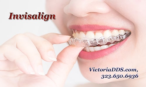 Instagram post by Dr. Victoria Olshansky: Want a beautiful smile? No more metal brackets - Invisalign is the solution. Invisalign system is a virtually invisible way to straighten yo…