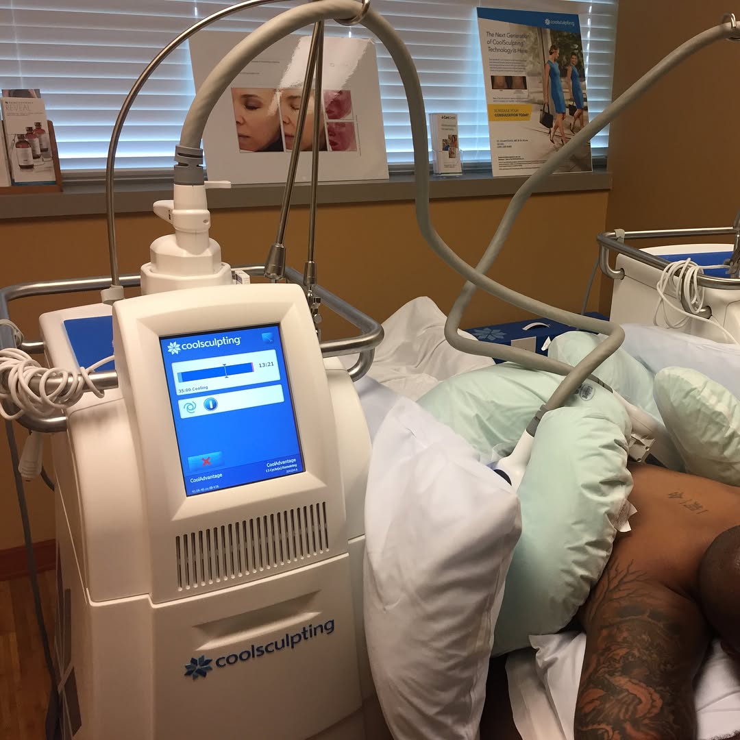 Instagram post by Dr. Vincent D. DiNick, D: Males sculpt too! Take a closer look at what the Coolsculpting process entails from start to finish with one of our patients during his trea…