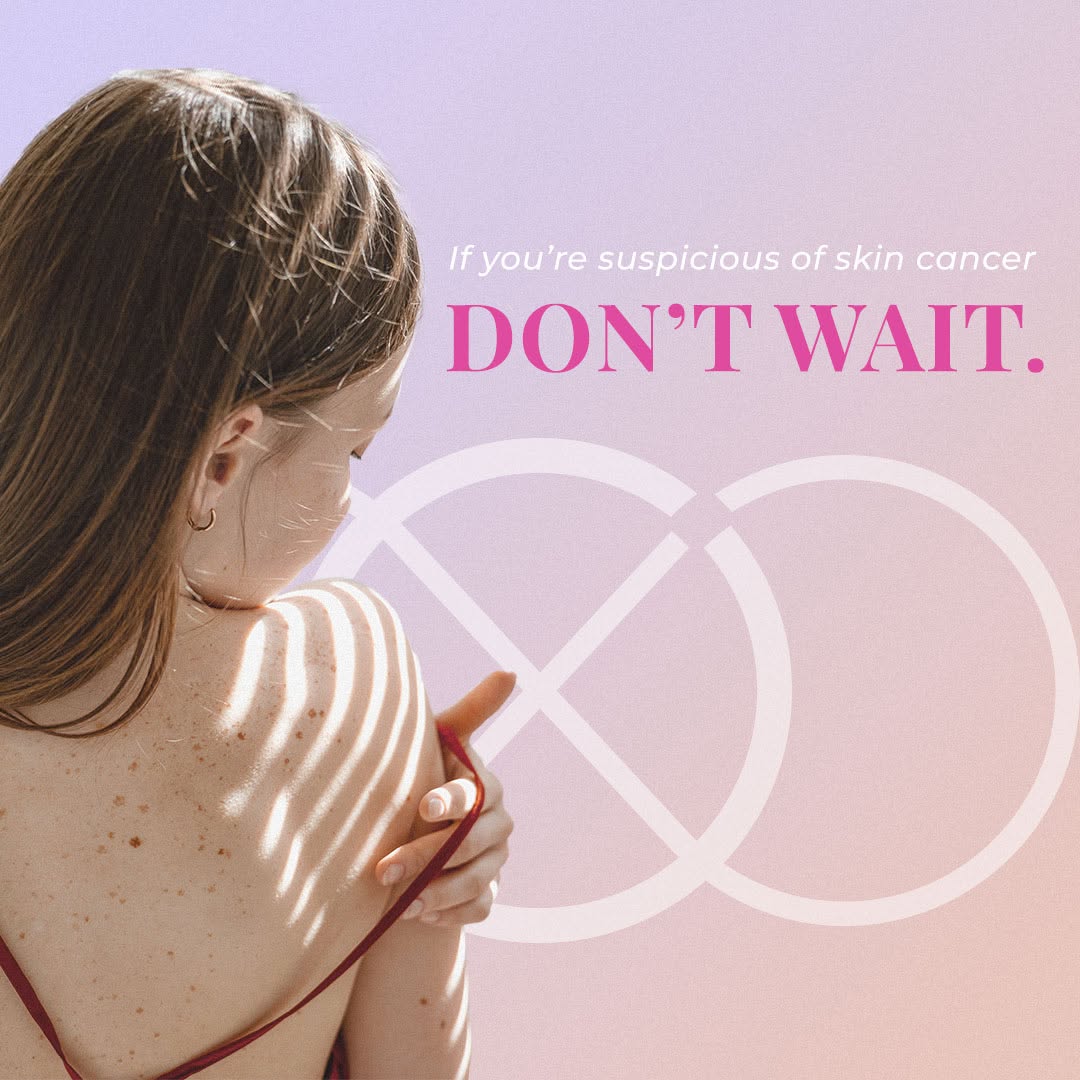 Instagram post by Dr. Vinod V. Pathy: It’s easy to overlook the early signs of melanoma. But if you’re suspicious of any areas of your skin, don’t wait to make an appointment. Ge…