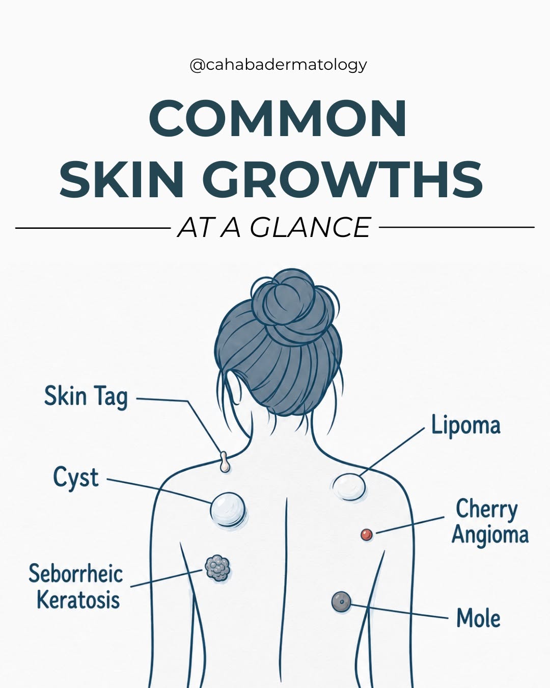 Instagram post by Dr. Vlada Groysman: Not every new spot on your skin means the same thing. Skin tags, cysts, lipomas, cherry angiomas, seborrheic keratoses, and moles can all lo…