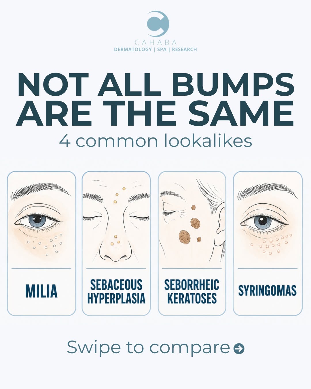 Instagram post by Dr. Vlada Groysman: Not every bump is acne. Milia, sebaceous hyperplasia, seborrheic keratoses, and syringomas can look similar but require different approaches…