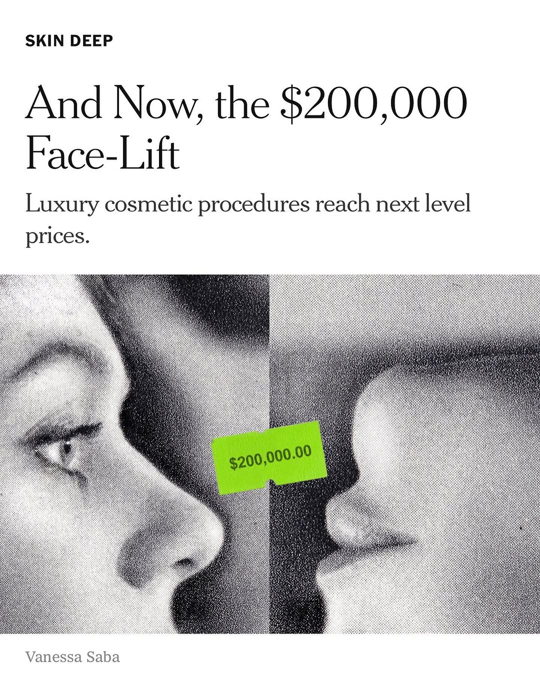 Instagram post by Dr. W. Matthew White: We do it for the Love ❤️ ! @nytimes Great article by the ever-talented @tatianaboncompagni on the changing landscape of aesthetic surgery. I…