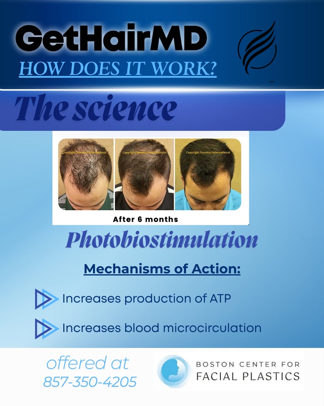 Instagram post by Dr. Waleed Ezzat: GetHairMD, but make it science 🧠✨ If you have been wondering how laser hair restoration actually works, here is the simple version 👇 💡 Lo…