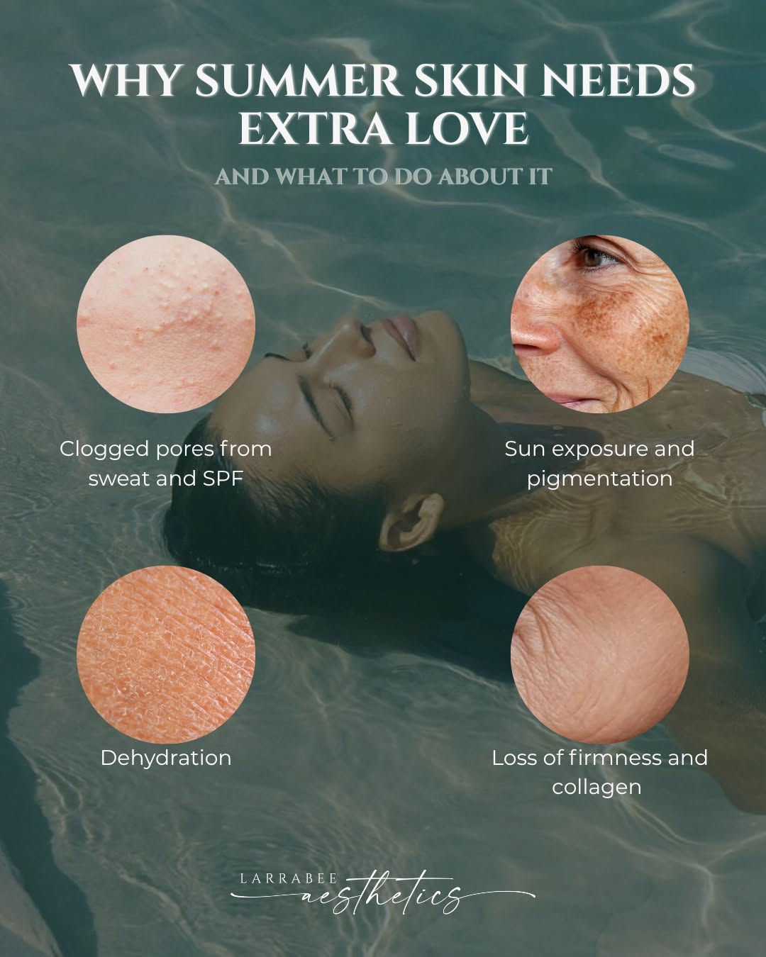 Instagram post by Dr. Wayne F. Larrabee: Summer is great — but it is not always kind to your skin! Clogged pores, sun damage, dehydration, and loss of firmness are all common this t…