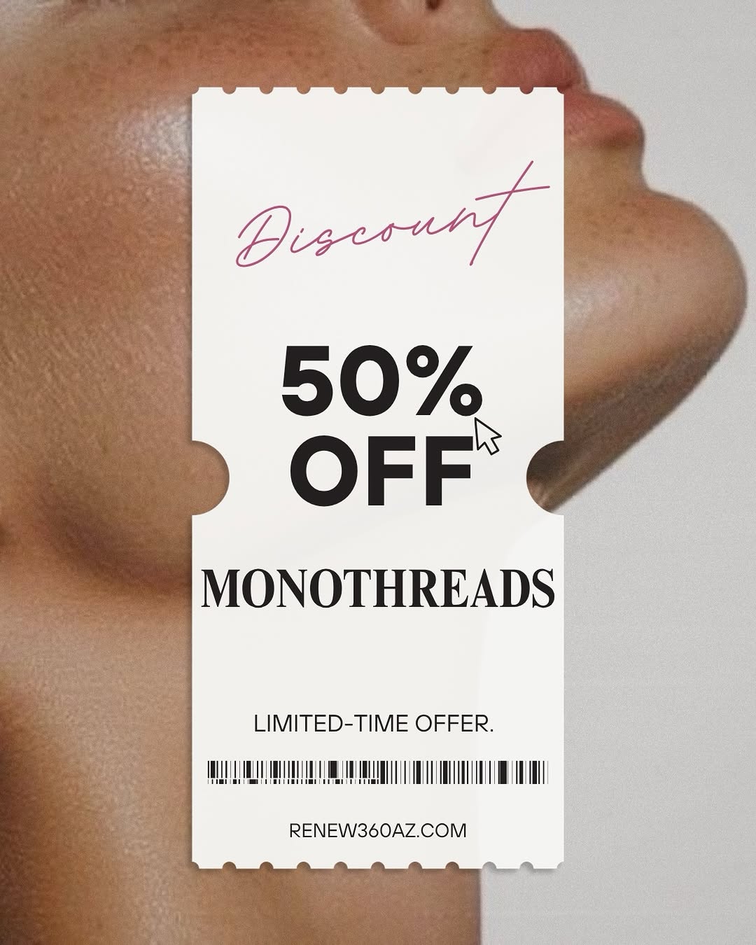 Instagram post by Dr. Weimin K. Hu: 50% OFF MONOTHREADS ✨ Not sure what monothreads are? These smooth, dissolvable threads are placed beneath the skin to help stimulate collage…