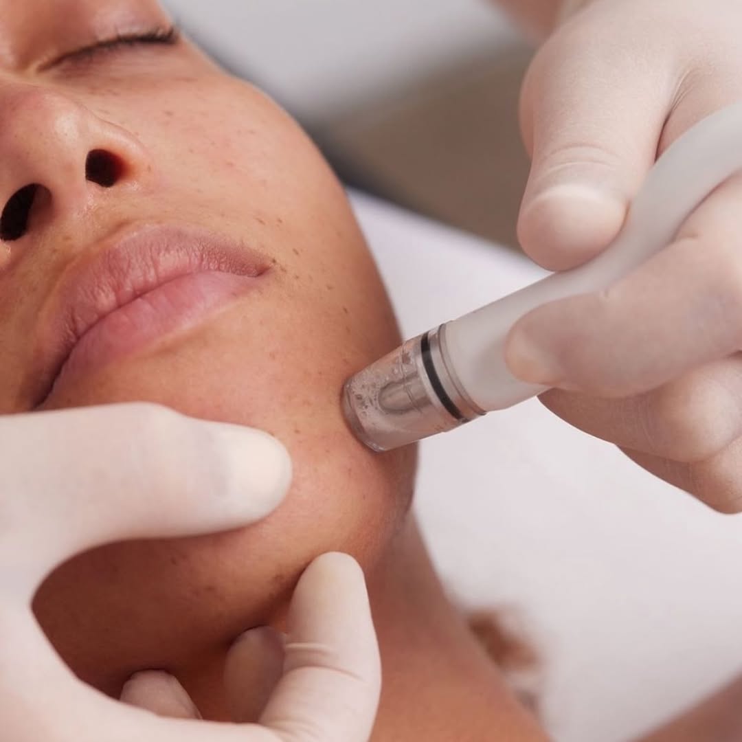 Instagram post by Dr. Wendy McFalda, DO: Experience DiamondGlow®—a next-level, noninvasive skin-resurfacing treatment, designed to work with SkinMedica® advanced skincare products. …