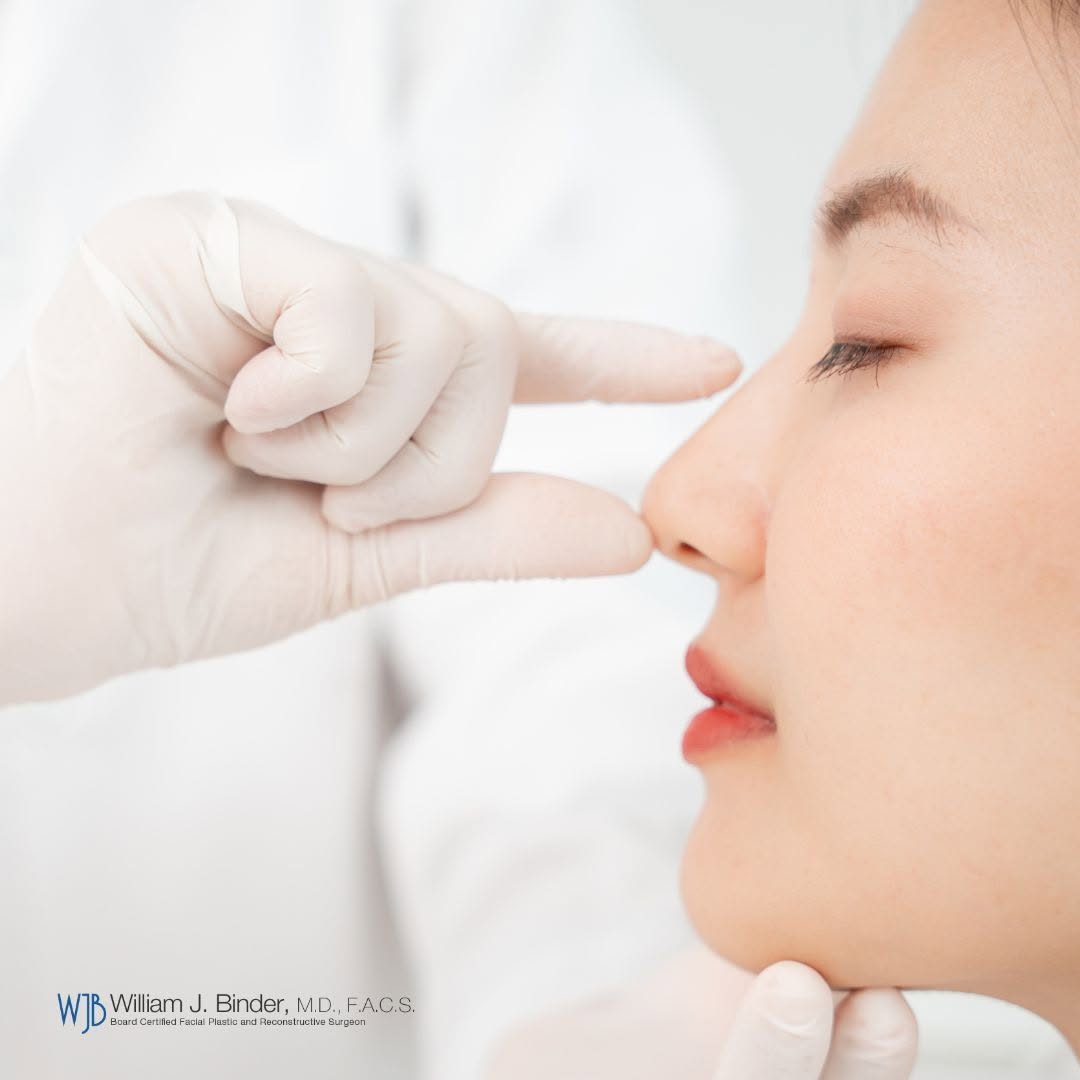 Instagram post by Dr. William J. Binder: People who want to proceed with rhinoplasty may put off the procedure due to fear of judgments, surgery, or financial strains, but if you’re…