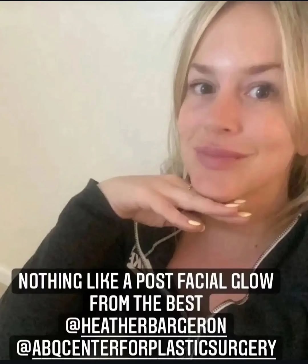 Instagram post by Dr. William Loutfy: We love our skincare clients! 🥰 #micropeel #thatglowtho #beautifulskinstartshere #heatherbargeronaesthetician #abqcenterforplasticsurgery
