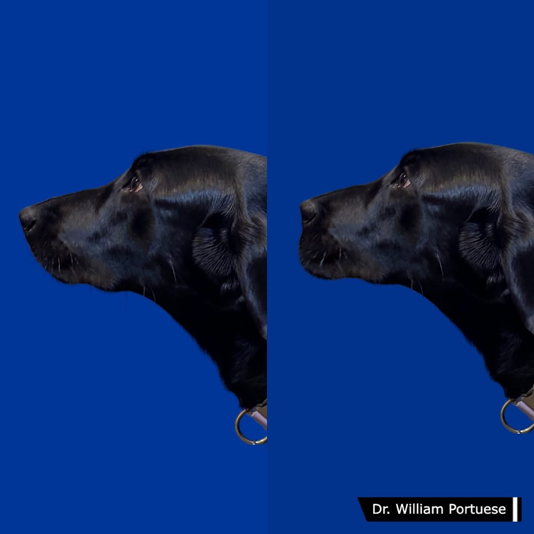 Instagram post by Dr. William Portuese: Meet Daisy May! She came to our office concerned about an overprojecting nose and an under-projected chin. After a rhinoplasty and chin impl…