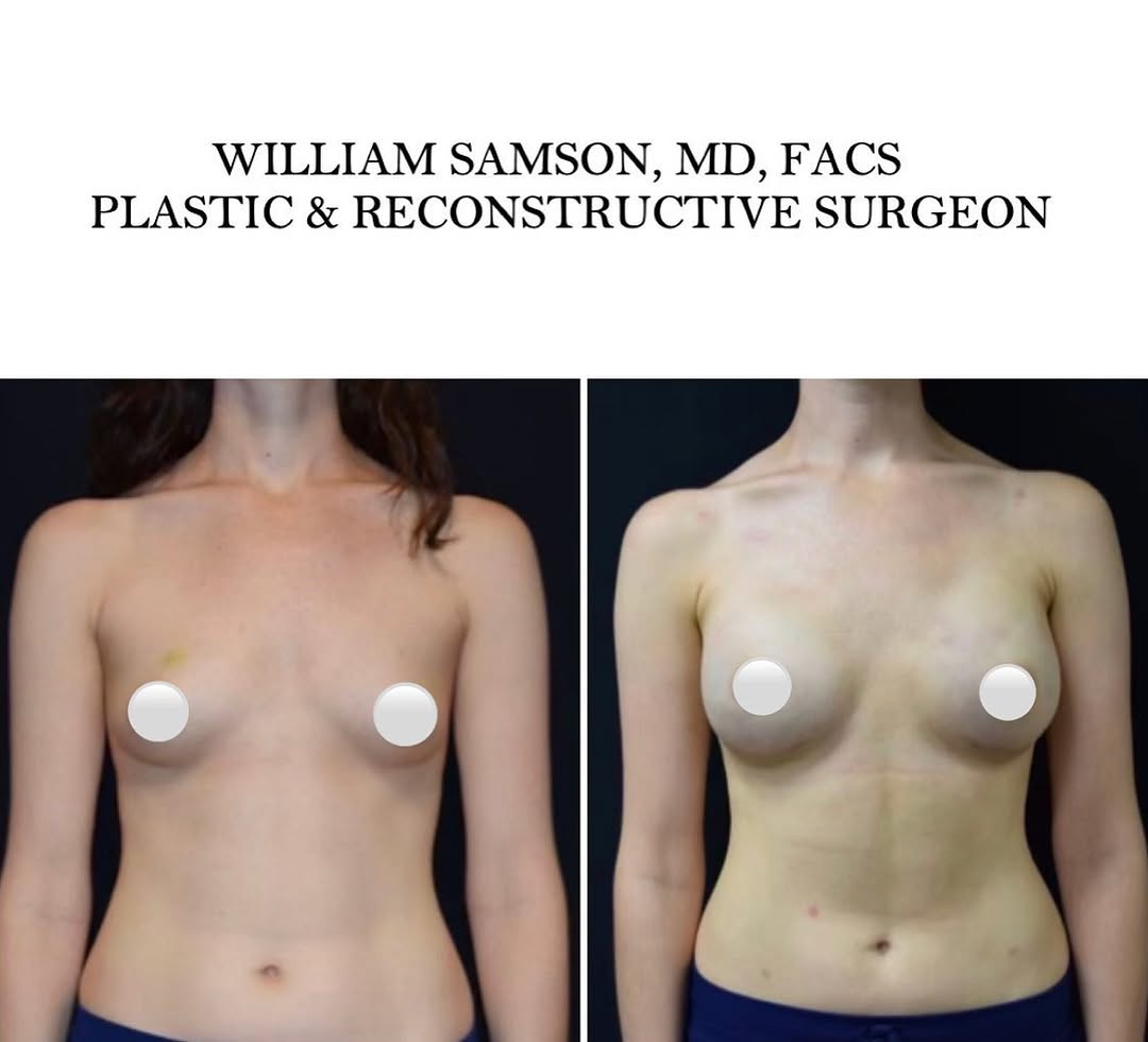 Instagram post by Dr. William Samson: A tribute to all breast cancer patients this month, Breast Cancer Awareness Month. You inspire me and motivate me. Special thanks to my pati…