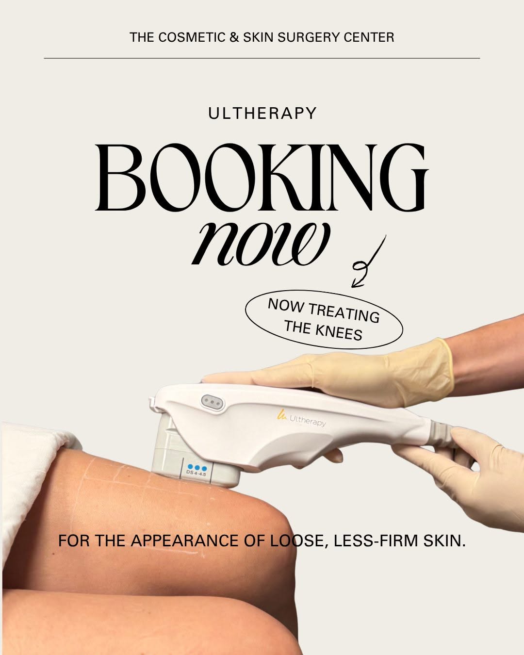 Instagram post by Dr. Wyatt C. To: Did you know Ultherapy PRIME® can go beyond the face? ✨ It’s now FDA-cleared for the KNEES. Skin laxity around the knees can become more not…