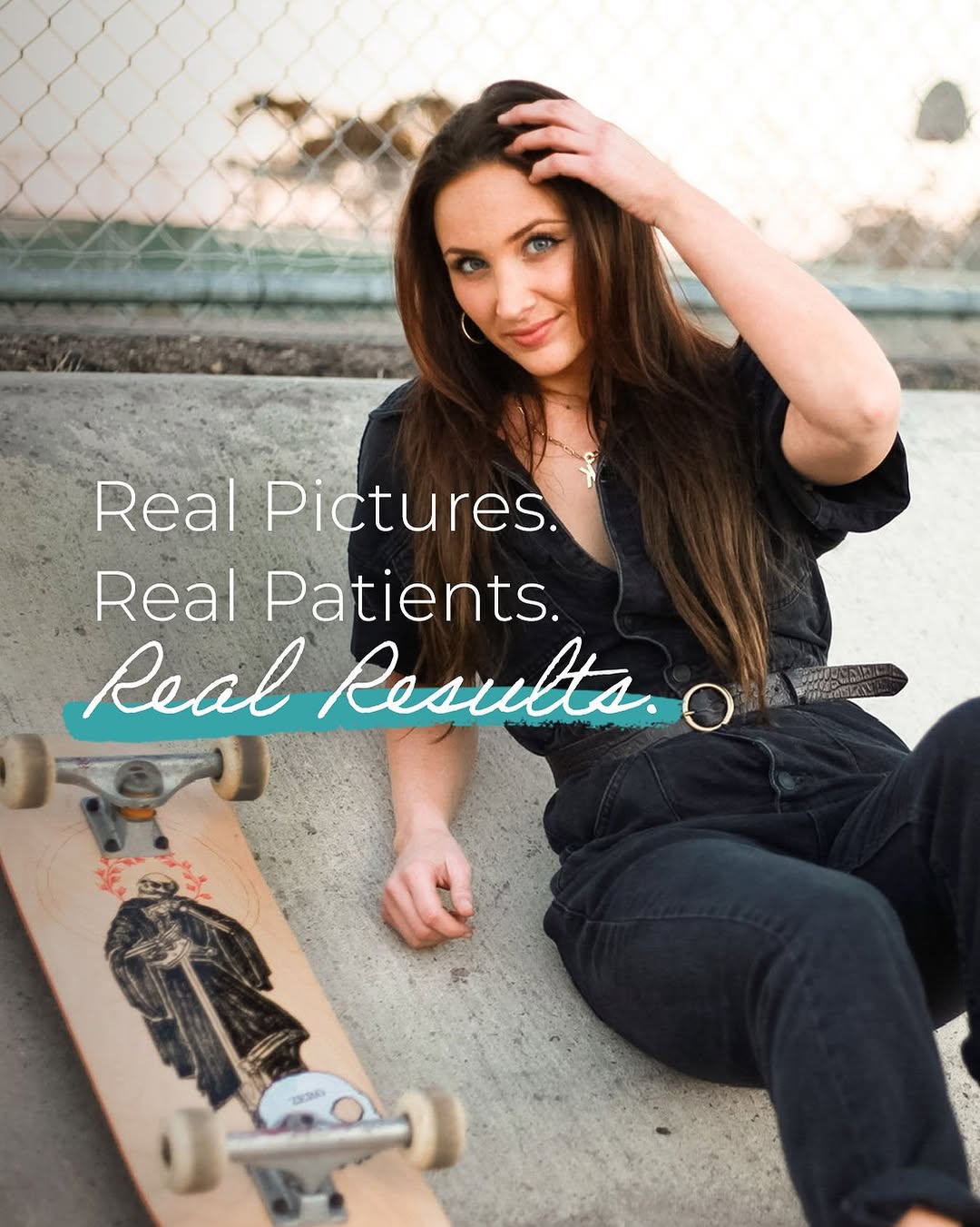 Instagram post by Dr. Yale M. Kadesky: We only use real photos of real patients. Dr. Yale Kadesky, one of San Diego's top plastic surgeons, believes that quality results require t…