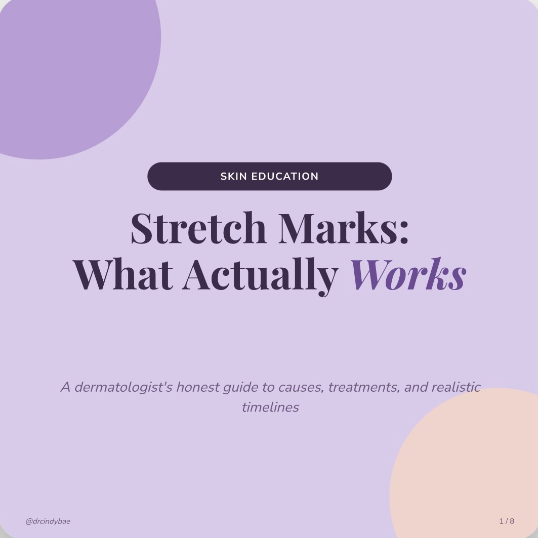 Instagram post by Dr. Yoon-Soo Cindy Bae: Stretch marks aren’t a life sentence. Swipe through for what actually helps, what to expect, and why we don’t oversell it. 🩶 Questions? Lin…