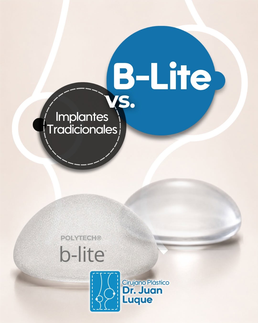 Instagram post by Juan Luque: ¿Por qué elegir B-Lite® sobre los implantes tradicionales? ♾︎Menos tensión: Reduce el impacto de la gravedad y cuida tus tejidos con los año…