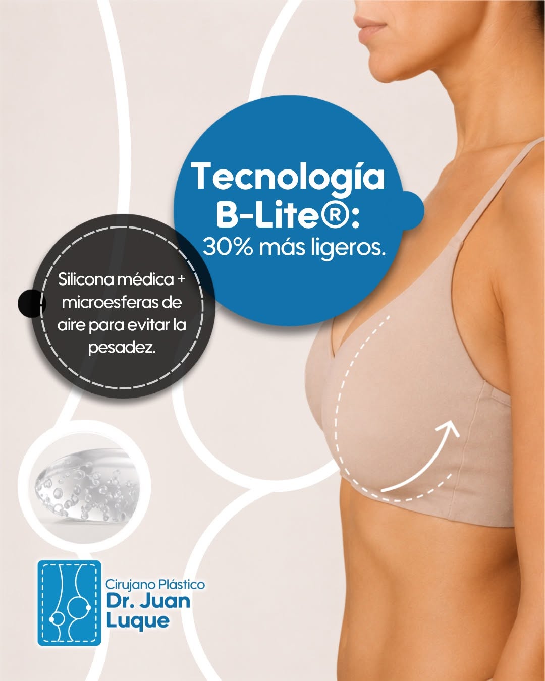 Instagram post by Juan Luque: ♾︎B-Lite®: La última innovación en implantes mamarios que combina gel de silicona con microesferas de aire para darte la firmeza, la forma y…