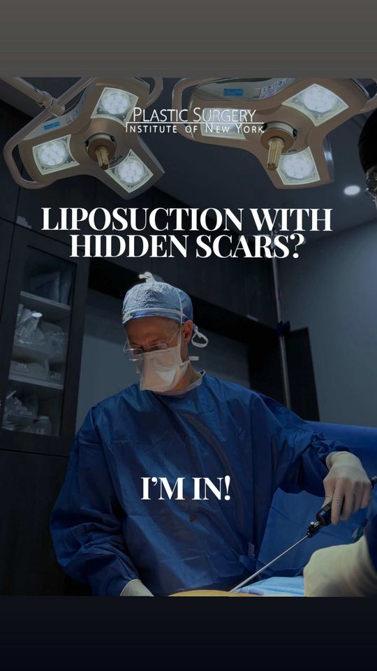 Video by Dr. Adam Schaffner: Scarring can feel like a barrier to your dream results, but with the right surgeon, it doesn’t ha…