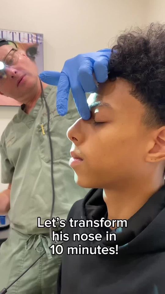 Video by Dr. Alexander Ovchinsky: Watch Dr. O transform his nose in ten minutes with a 💉👃🙌