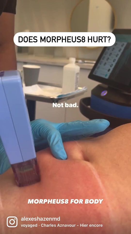 Video by Dr. Alexes Hazen: Any discomfort that is felt during the treatment is often very tolerable. Our team will also appl…